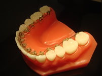 �C���R�O�j�[�g